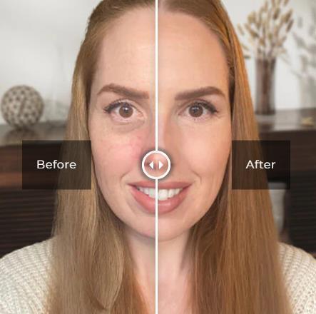 Eye Care Products - Image 2